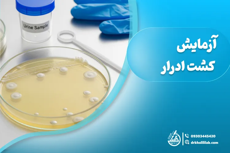 آزمایش کشت ادرار: دلایل، نحوه انجام و تفسیر نتایج