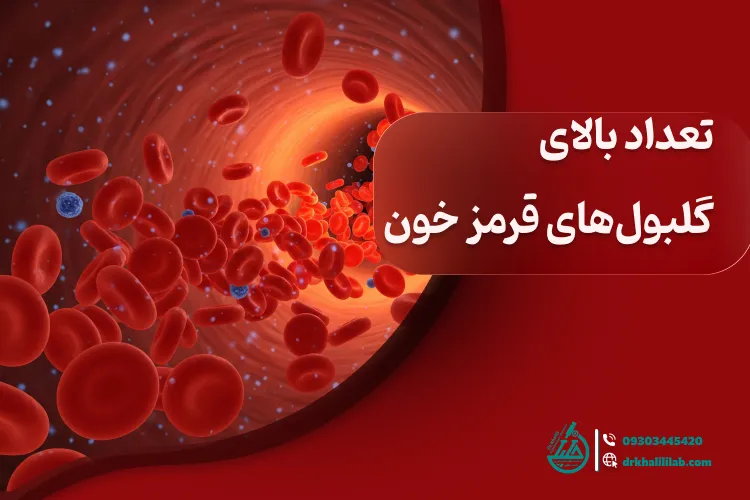 تعداد بالای گلبول‌های قرمز خون: دلایل، علائم و درمان