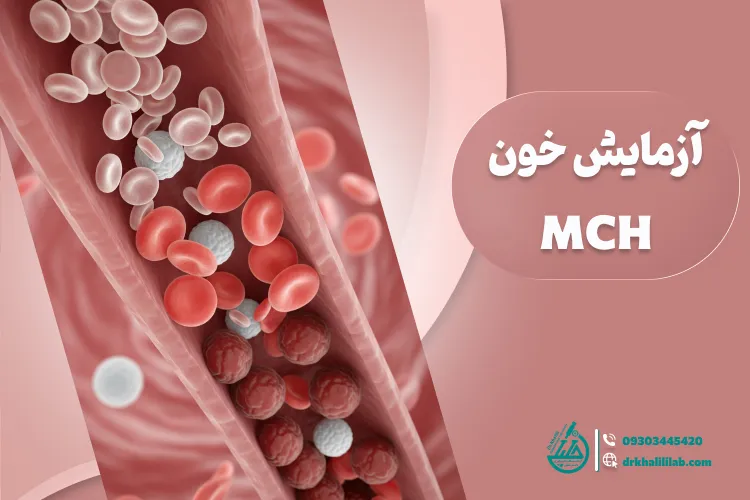 آزمایش خون MCH: تشخیص، آمادکی و تفسیر نتایج