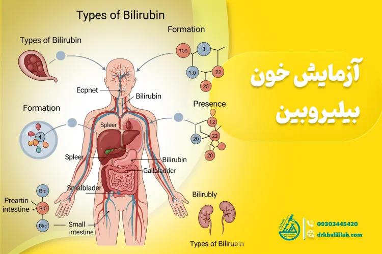 آزمایش خون بیلی روبین: علل، علائم و تفسیر کامل نتایج