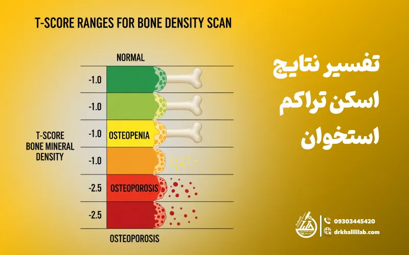 تفسیر نتایج اسکن تراکم استخوان