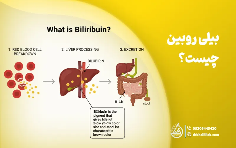 بیلی‌ روبین چیست؟
