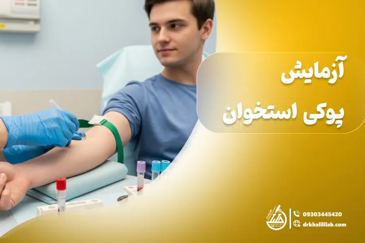 آزمایش پوکی استخوان: اسکن تراکم استخوان