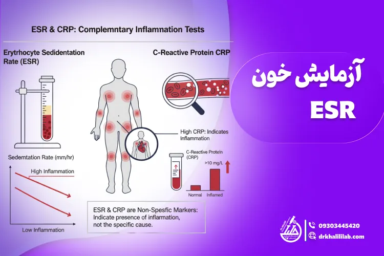 آزمایش خون ESR: انوع، مزایا، کاربرد و تفسیر نتایج