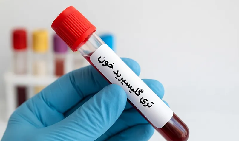 چرا به آزمایش خون تری گلیسیرید نیاز داریم؟